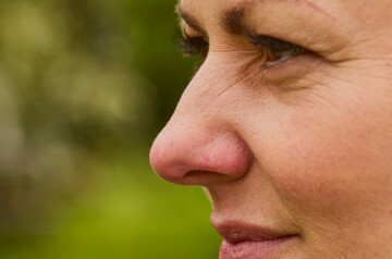 Nahaufnahme einer Frau im Profil, die im Freien in einem Garten sitzt. Sie trägt eine grüne Jacke und hat braune Haare. Ihr Gesichtsausdruck wirkt nachdenklich, möglicherweise aufgrund von Beschwerden durch eine trockene oder wunde Nase. Im Hintergrund sind unscharfe Bäume und Wiesen zu erkennen.